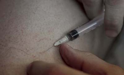 Vaisseau avant scl&eacute;rose